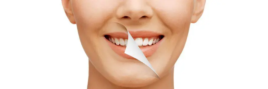 A Glimpse On Teeth Whitening Alternatives