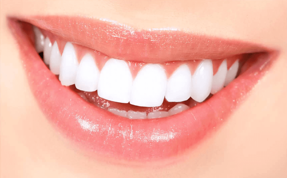 Teeth Whitening – An Overview