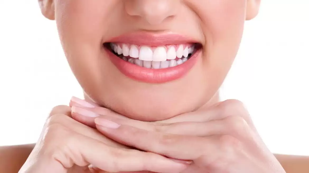 Why Should You Get Professional Teeth Whitening in Melbourne