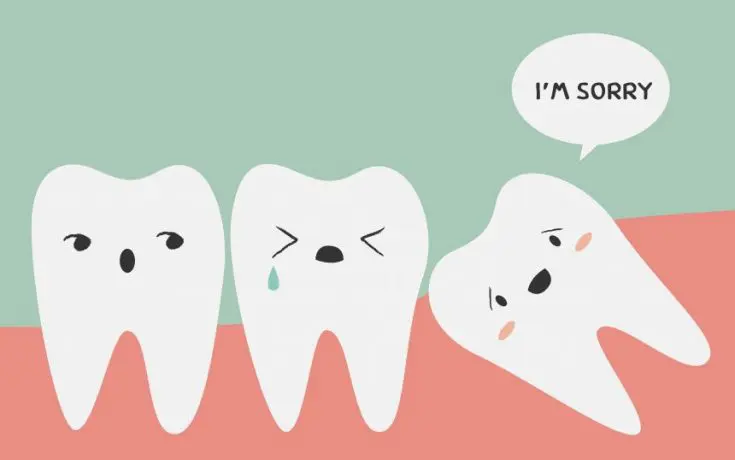 Wisdom Teeth Removal Melbourne 101 – The Ultimate Guide