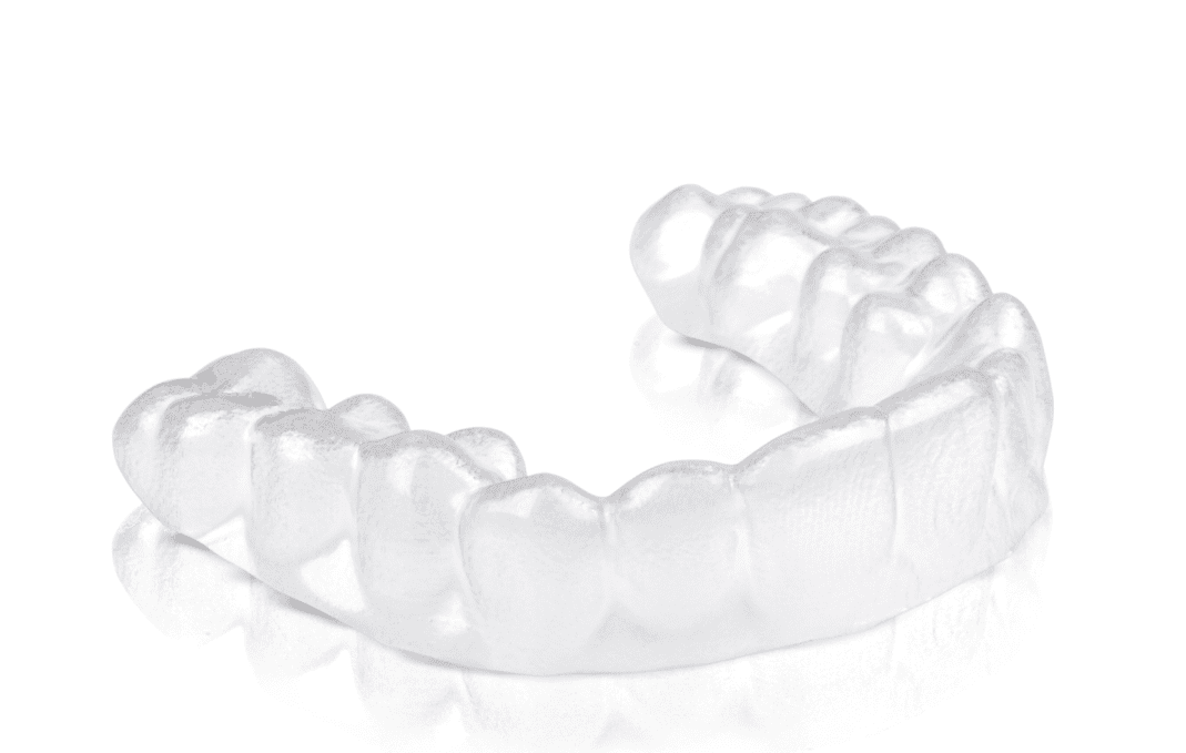 Why Prefer Invisible Braces over Classic Braces