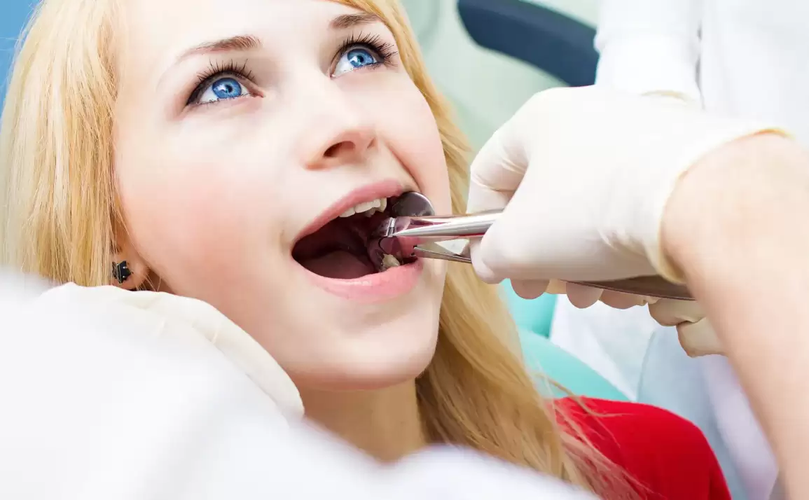 Procedure of Wisdom Teeth Removal in Melbourne – No Gap Dentists