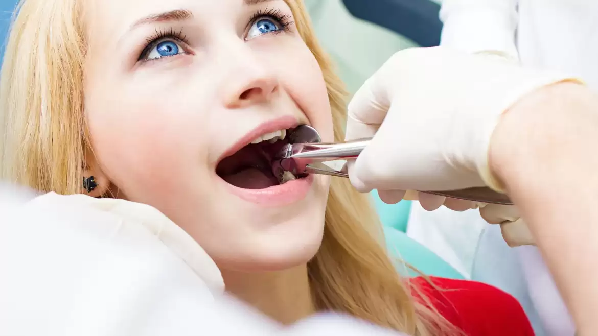 Procedure of Wisdom Teeth Removal in Melbourne – No Gap Dentists