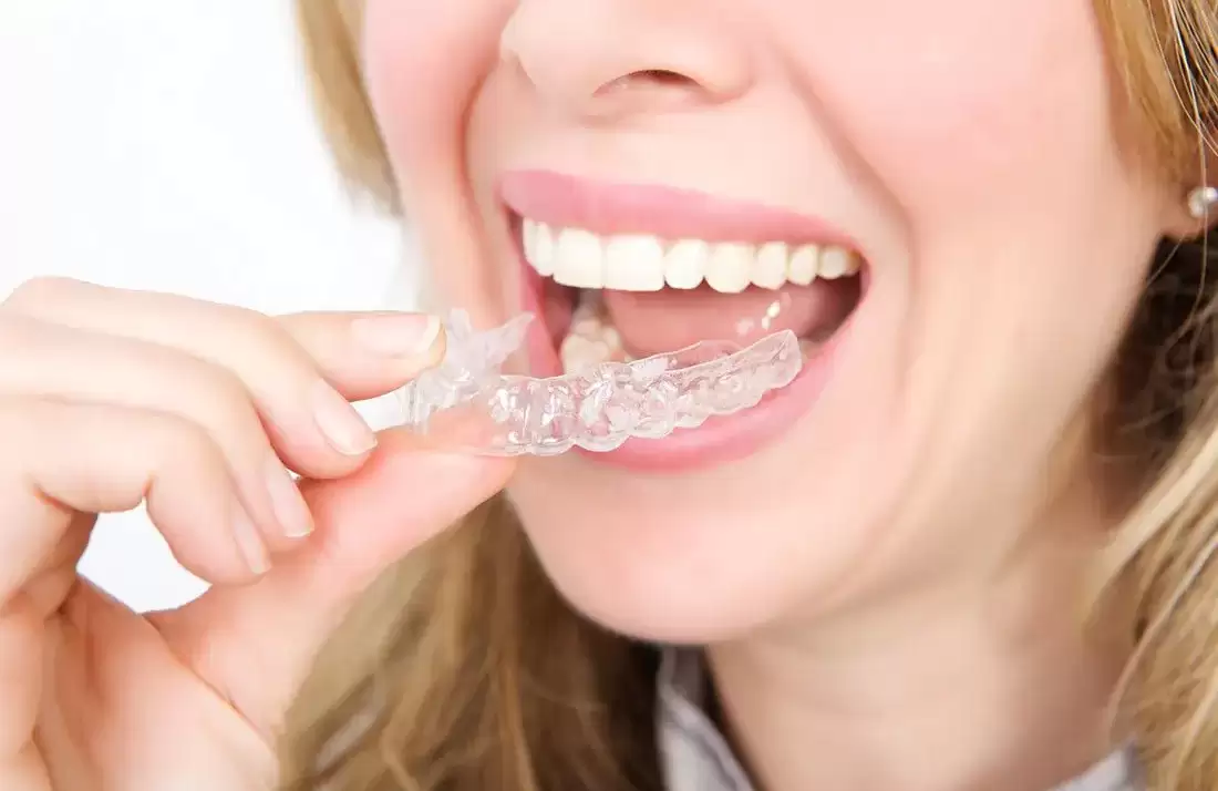 Invisible Braces: A Solution to the Social Stigma of Metal