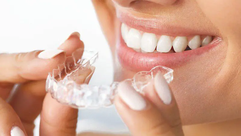 Common Dental Issues that Invisible Braces Can Fix