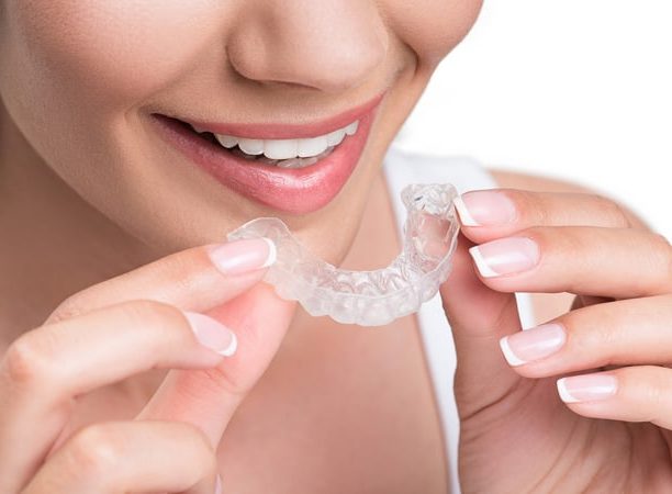 Should you opt for Invisible Braces Treatment?
