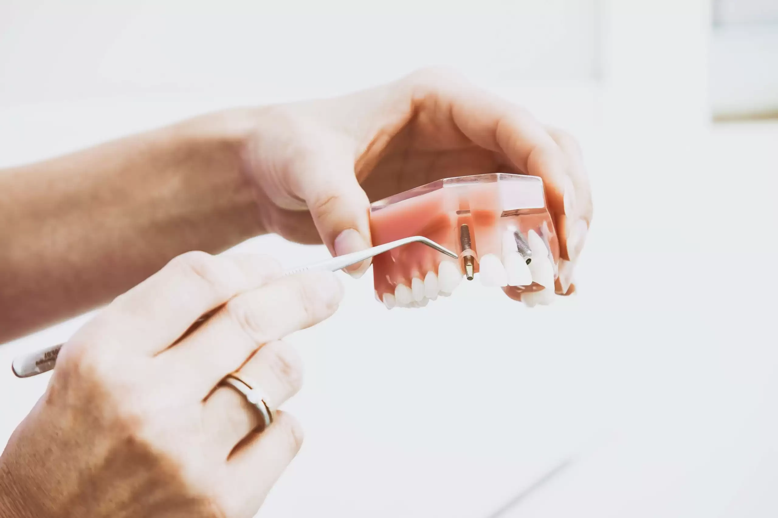 6 Tips to Care Your Dental Implants 99 Affordable Dentist Melbourne