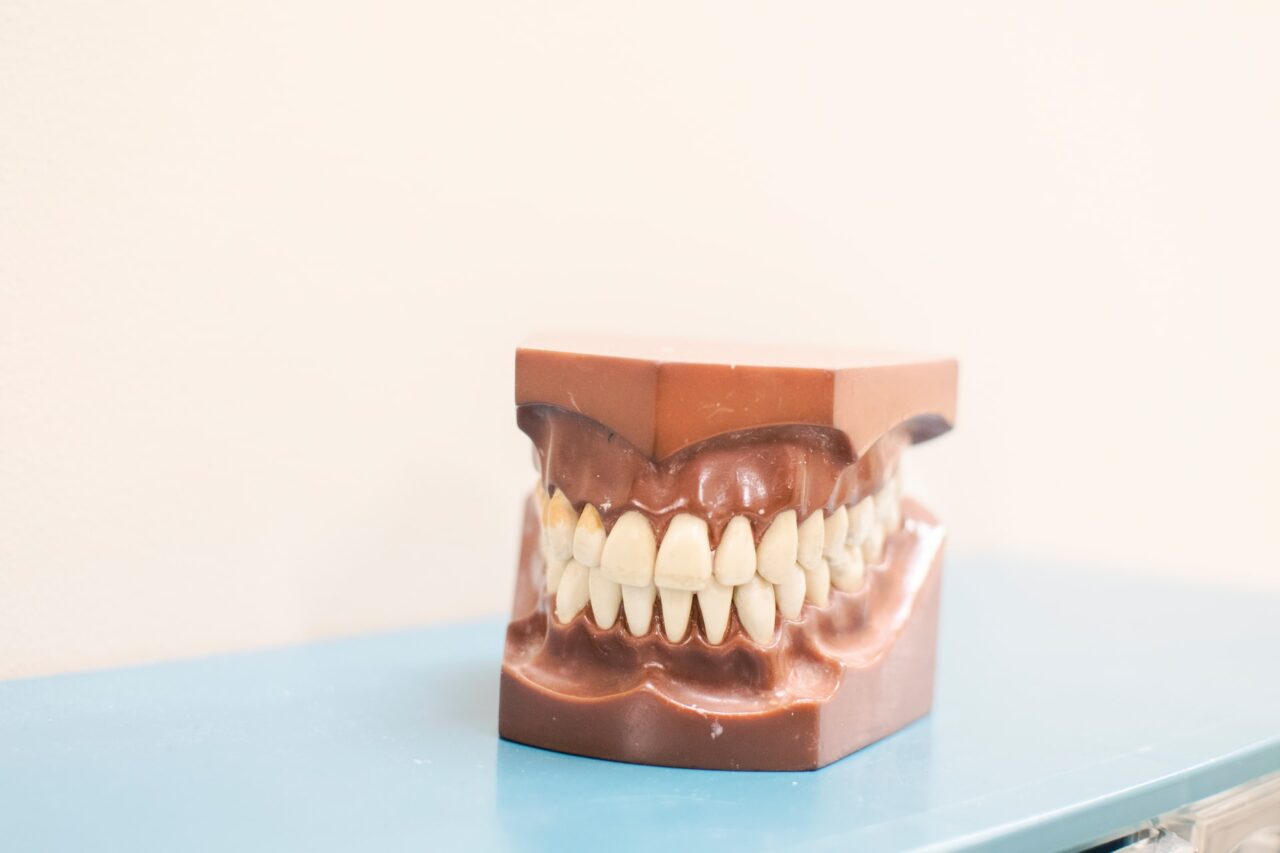 Teeth Discolouration