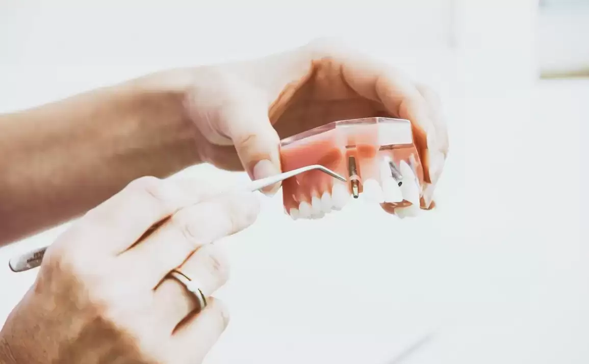 Dental Implants Melbourne – Why they’re Worth Considering