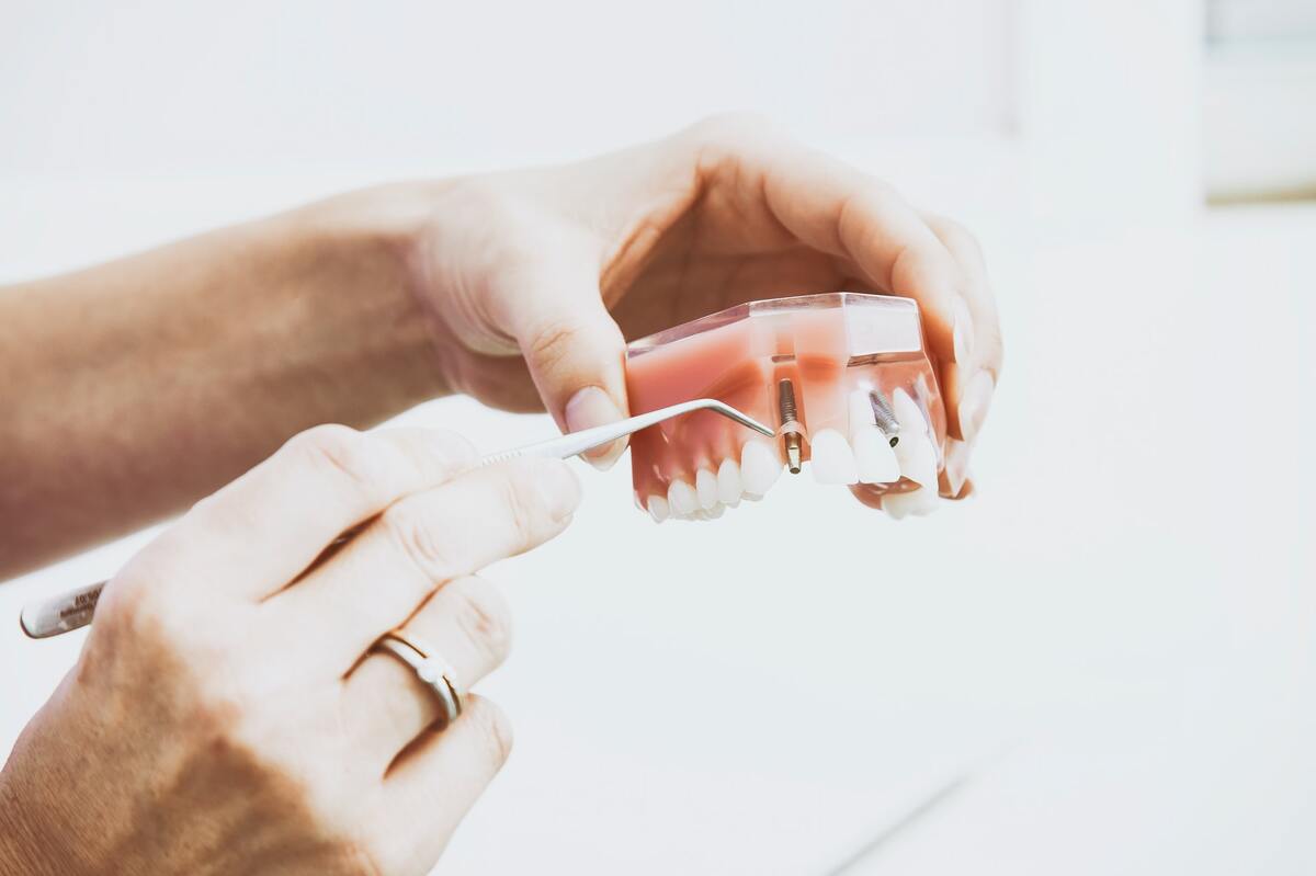 Tooth implants in Melbourne
