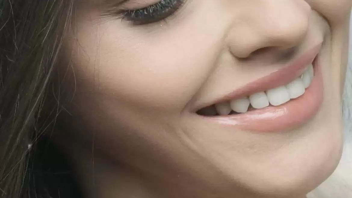 Teeth Whitening: Why You Should Leave It To The Professionals