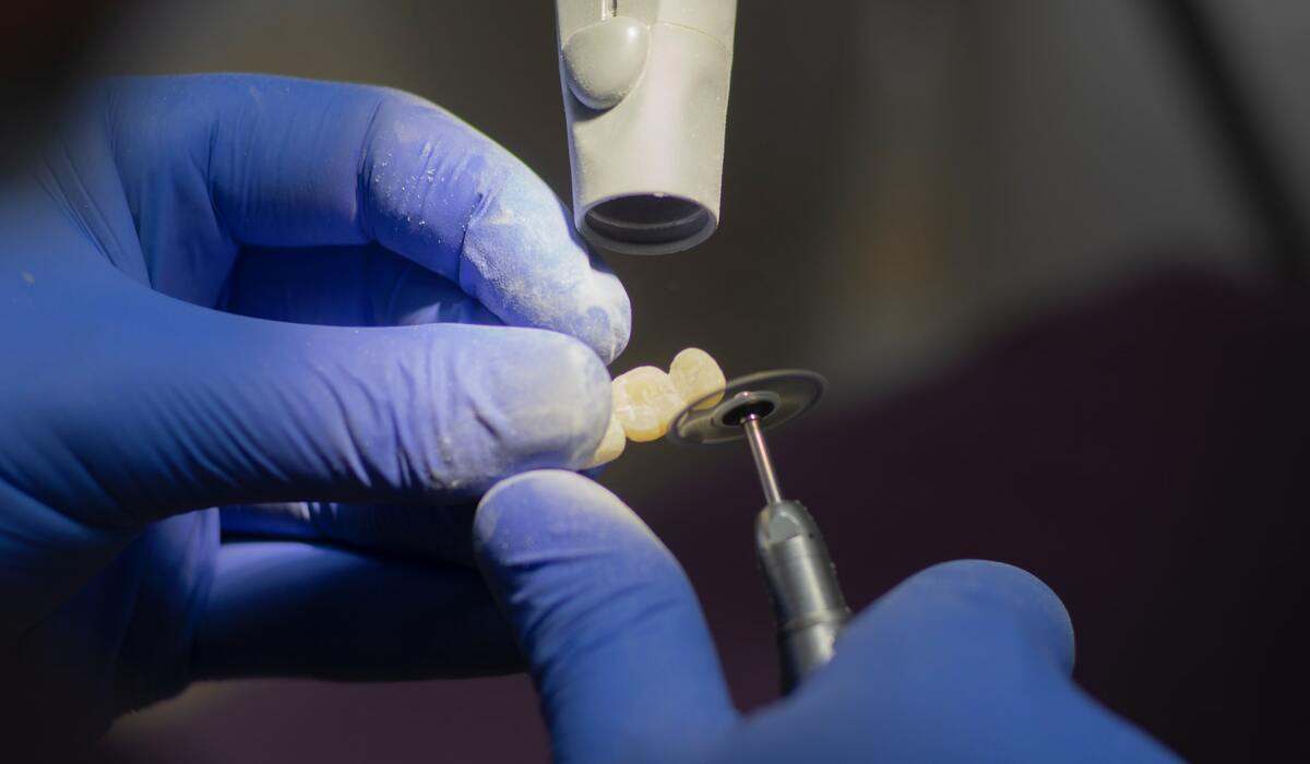 dental implants cost in Melbourne