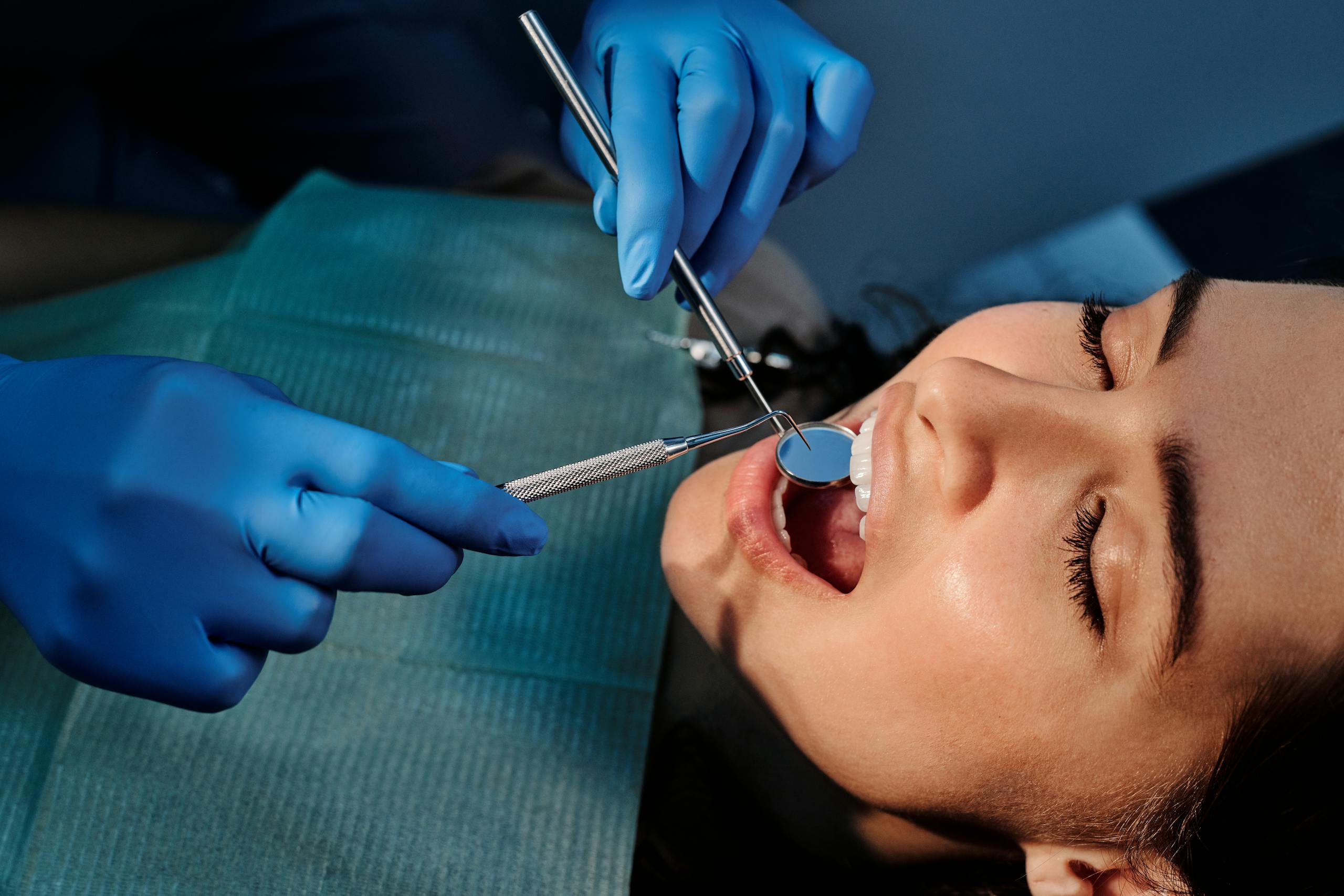 wisdom teeth removal - no gap dentists - melbourne