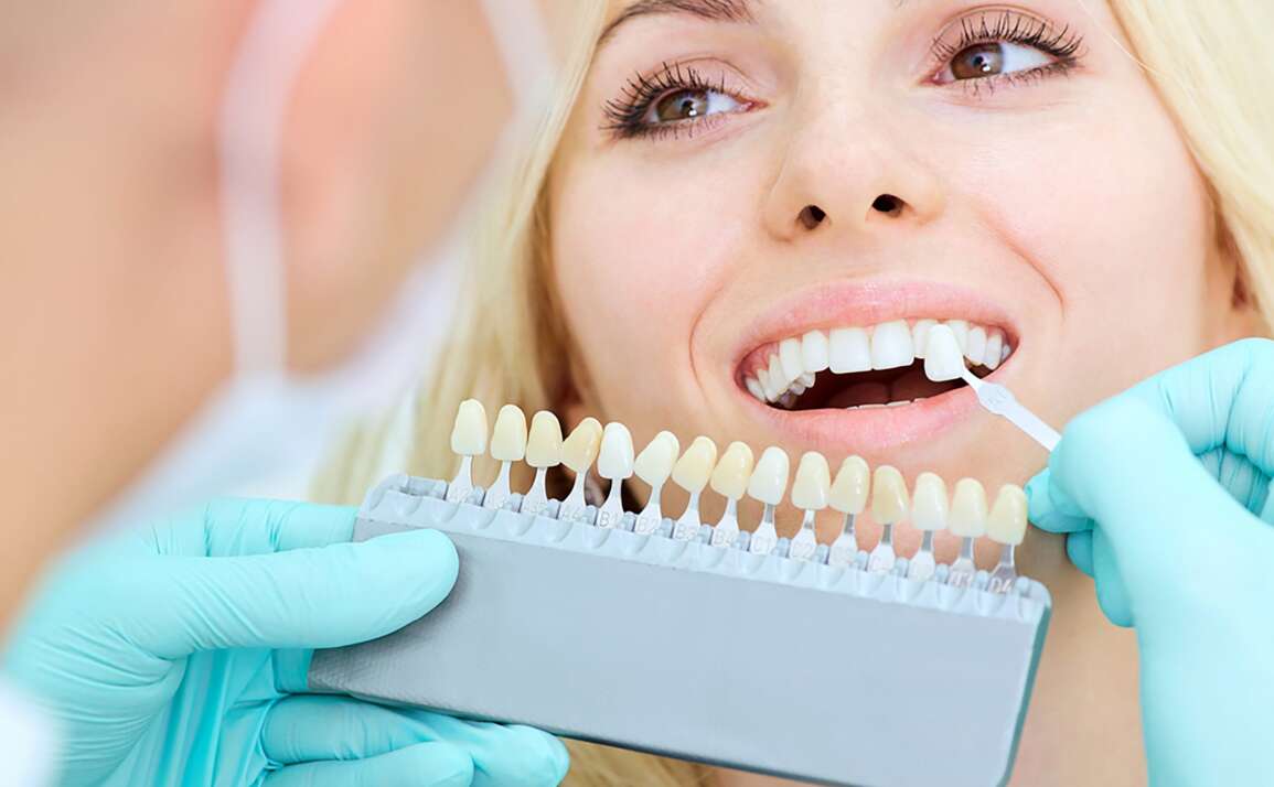 Why Professional Teeth Whitening by a Dentist is Always Better than DIY