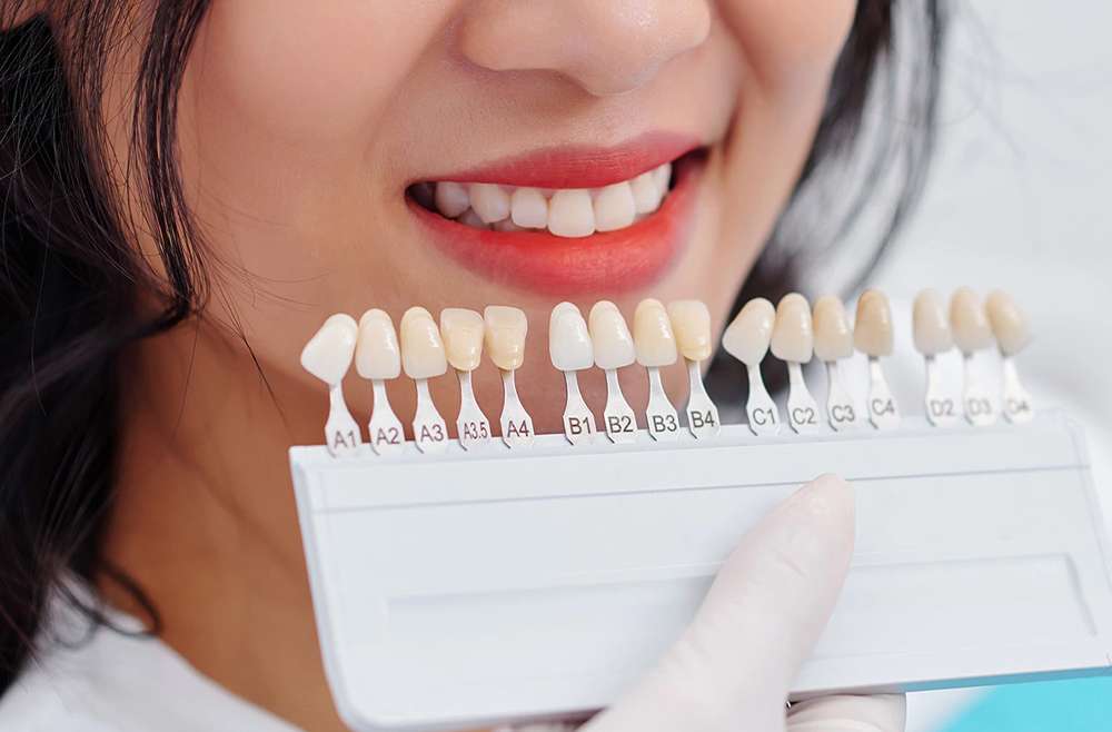 Your Guide to Achieving a Perfect Smile: Teeth Whitening and Dental Implants