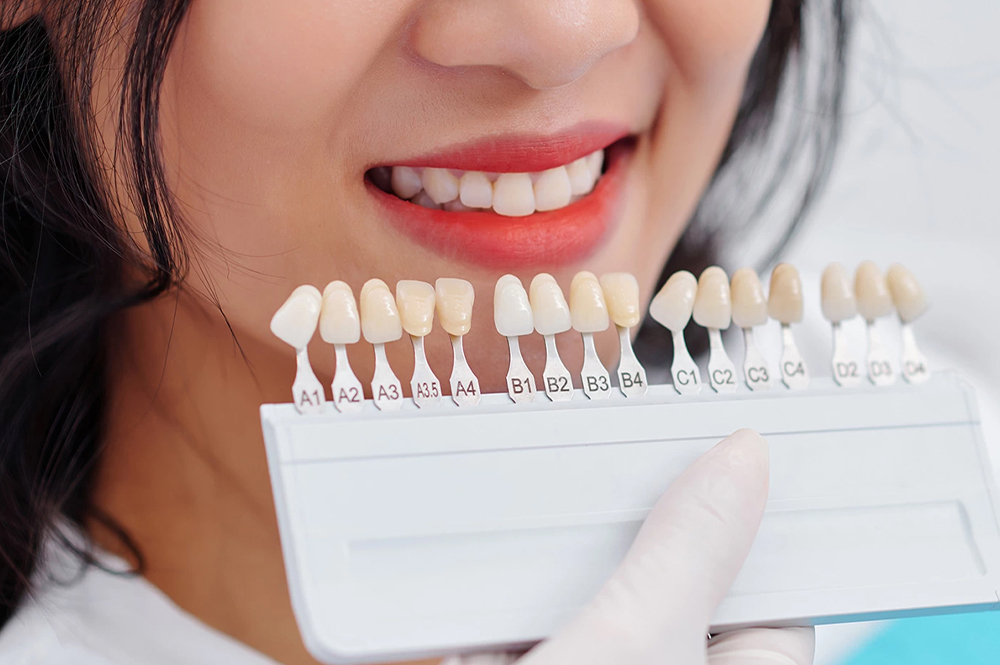 Your Guide to Achieving a Perfect Smile: Teeth Whitening and Dental Implants