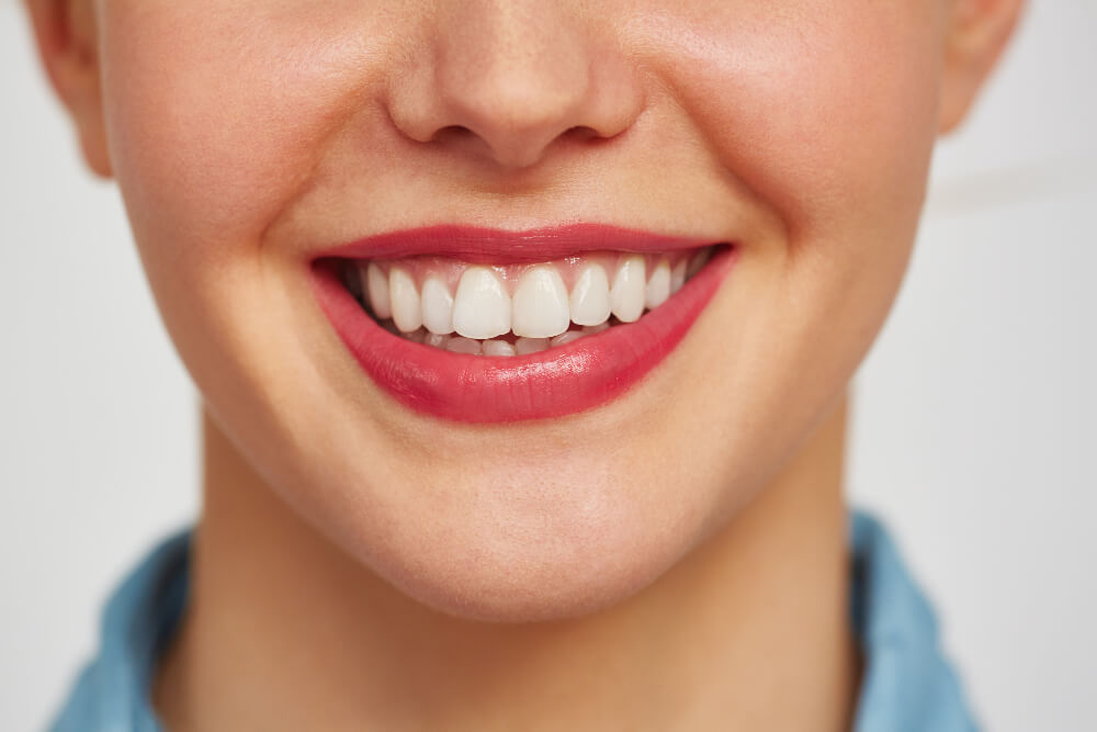 Smiling girl with white teeth after professional teeth whitening treatment
