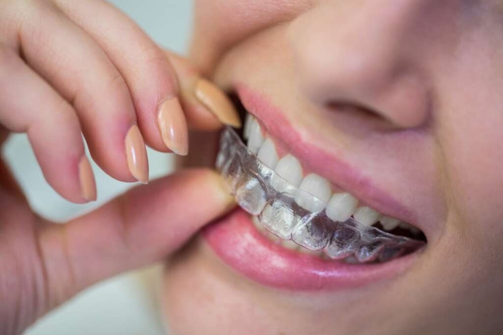 Woman smiling while wearing Invisible Braces for discreet orthodontic care