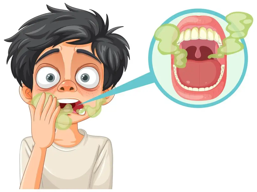 Wisdom teeth causing bad breath and swollen gums illustration