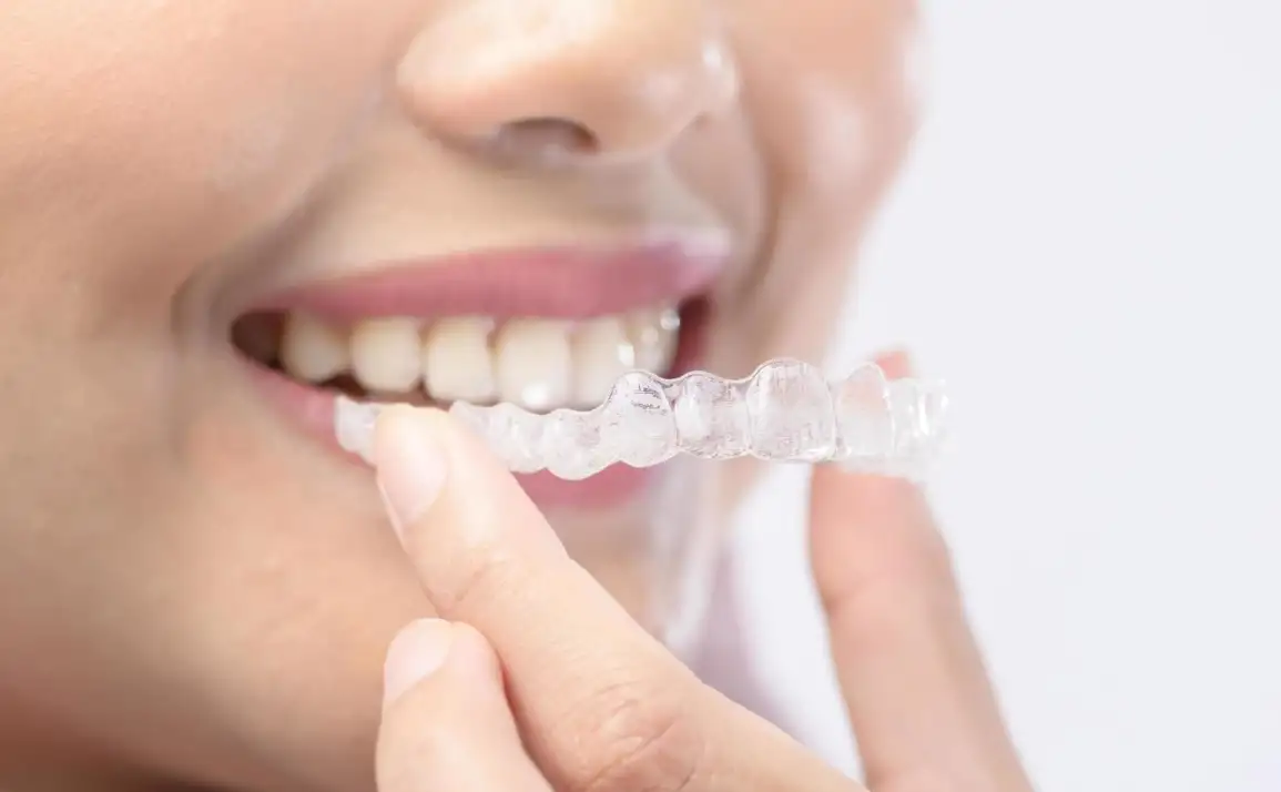 Can You Get Invisible braces on Medicare? What Aussie Patients Need to Know