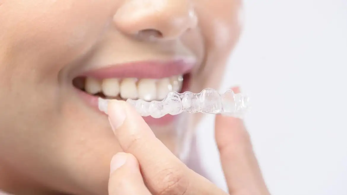 Can You Get Invisible braces on Medicare? What Aussie Patients Need to Know